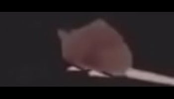 কিস পিকচার